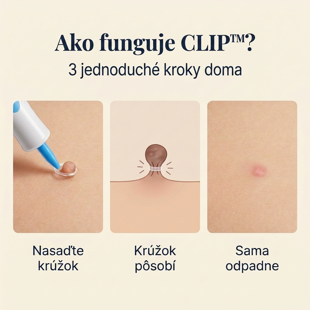 CLIP