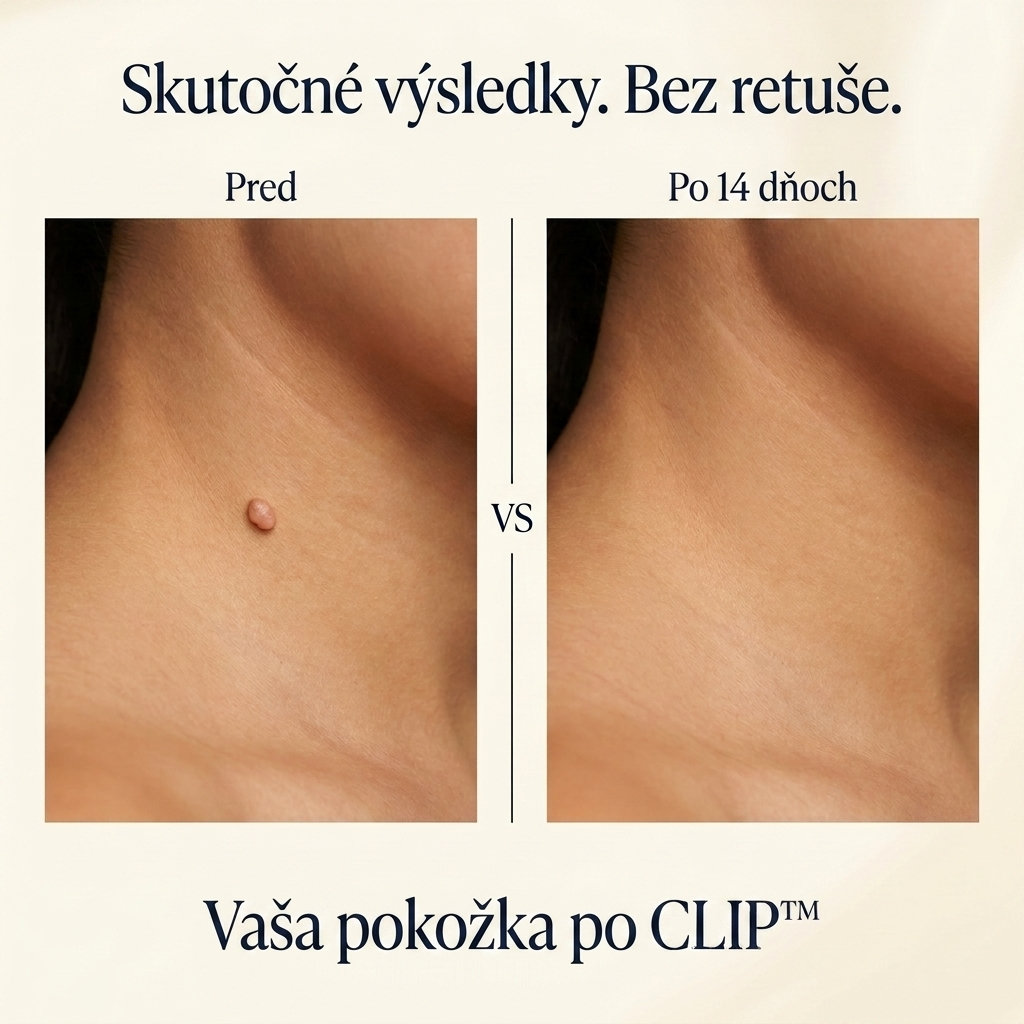 CLIP